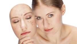 FR~HAUT presenta esta nueva línea blanqueante que consigue resultados visibles desde la primera sesión