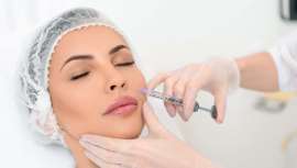 Con una sesión se reducen imperfecciones, líneas finas de expresión, pequeñas cicatrices o marcas de acné