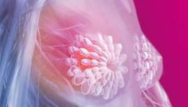 A pesar de que los tratamientos y la investigación progresan constantemente, la atención a las secuelas quirúrgicas y de postoperatorio no siempre se tiene en cuenta