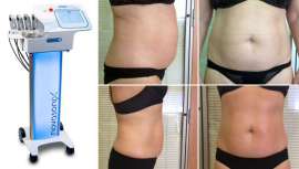 El equipo de Novasonix ofrece tecnología de vanguardia para estilizar la figura, mejorar el metabolismo y reducir el contorno