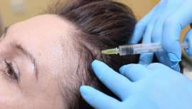 Slow Life House presenta esta mesoterapia anticaída y fortalecedora del cabello, basada en la introducción de 56 principios activos. Los resultados son tan prometedores como para hablar de un antes y un después en mesoterapia capilar