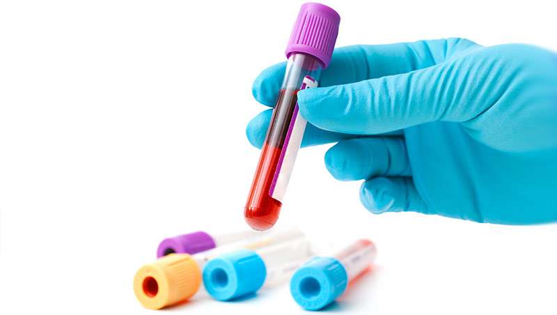 analisis de sangre para detectar el cancer