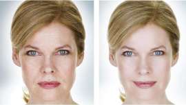 Uma potente corrente de CO2 combinada com uma altíssima concentração de ativos, a alta pressão e muito baixa temperatura: chega o futuro no rejuvenescimento facial