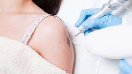 A dra. Maria José Alonso, membro da Academia Española de Dermatologia e Venerologia, propõe algumas orientações a considerar antes de pensar em realizar uma tatuagem