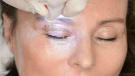El Instituto de Belleza y Medicina Estética Maribel Yébenes ofrece este programa indicado para rejuvenecer los párpados e iluminar la mirada