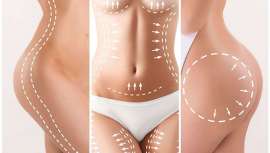 La cavitación es un tratamiento de estética consistente en aplicar ultrasonidos en diferentes zonas del cuerpo para eliminar acúmulos de grasa localizada. Repasamos a fondo esta avanzada técnica y la última aparatología del mercado