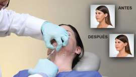 Belkyra es el único tratamiento inyectable no quirúrgico que ha sido sometido a una rigurosa evaluación clínica, incluyendo cuatro estudios clínicos de fase tres que involucran a más de 2.600 pacientes en todo el mundo