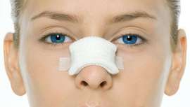 Según un experto, el Dr. Javier Galindo, el intrusismo y las clínicas low cost son los responsables del aumento de este tipo de intervenciones secundarias