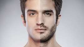 A barba começa a ser uma obsessão para aqueles que querem mudar de look adaptando-se às novas tendências. Os implantes de barba desembarcam nos salões de beleza de toda a Europa