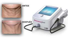 Se trata de una revolucionaria tecnología de segunda generación de HIFU facial, con sistemas de control electrónico, que provienen de los láseres para la búsqueda de máxima eficacia con la mínima molestia