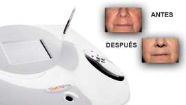 Quantum Technology presenta esta tecnología no quirúrgica, capaz de erradicar la mayoría de las lesiones vasculares faciales y corporales