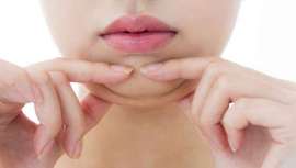 El tratamiento consiste en aplicar una inyección de ácido desoxicólico que elimina las células grasas y mejora el mentón. Por primera vez, se puede tratar la papada, de manera definitiva, sin pasar por el quirófano