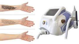 El tratamiento láser de carbón activo es un tratamiento novedoso que incide en un peeling, higiene y rejuvenecimiento de la piel 