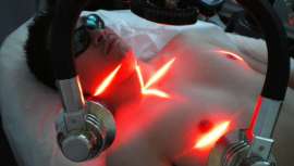 El láser Zerona es la mejor alternativa en el tratamiento de la ginecomastia. Láser de luz fría, alternativa a la liposucción por ser un procedimiento mínimamente invasivo sin efectos secundarios, de resultados visibles y duraderos 