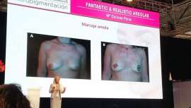 En el marco de Salón Look, Mª Dolores Pérez Sancho, directora del Centro de Formación Pretty Clinic, ha tenido una intervención destacada con su exposición teórica y construcción práctica de una areola en mujeres mastectomizadas