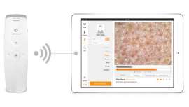 Analiza, diagnostica y recomienda los productos óptimos para tus clientes y avala tu profesionalidad con este equipo de tecnología avanzada. Hazte con API 202 en la semana de la oferta especial Black Friday y ponle freno a la caída