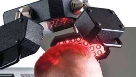 Más del 30% de la población padece pérdida de cabello. FCC Hair, sistema único de láser, productos a la vanguardia y cosmética capilar, se convierte en un servicio revolucionario que suma clientes y genera beneficios en una curva ascendente