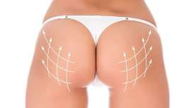 En 2016 se realizaron más de 20.000 operaciones de este tipo, un aumento de más del 3.000% con respecto a 2002