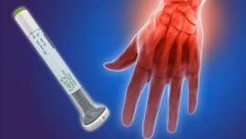 La farmacéutica Eli Lilly and Company ha anunciado que la Administración de Alimentos y Medicamentos de los Estados Unidos (FDA) ha aprobado el uso de este medicamento para tratar una artritis que afecta a 1,6 millones de americanos