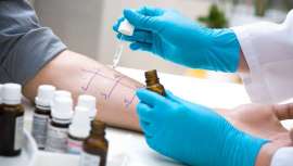 BioMarkers identifica los grandes grupos de alimentos responsables de múltiples estados de inflamación, y crea un plan de consejos nutricionales individualizados con el fin de recuperar de manera gradual la tolerancia a los alimentos