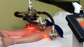 Rodillas y flancos, donde tratar la grasa es más difícil, se rinden al tratamiento del láser frío Zerona que hoy nos presenta Erchonia. Mínimamente invasivo e indoloro, con reducción de volumen comprobada