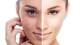 Las cicatrices, aunque en ocasiones no resulten problemáticas y nos olvidemos de ellas, en otras, sin embargo, suponen un estigma para el paciente. Revisamos con la Dra. Mª José Barba las distintas técnicas para su corrección