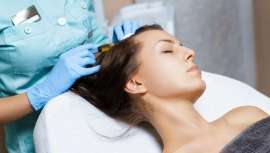 Este tratamiento mesoterapéutico estimula el cuero cabelludo y contribuye al crecimiento del pelo. Se trata de una buena alternativa a técnicas de trasplante capilar, que precisan cirugía como la FUE (Extracción Individual de Folículos)