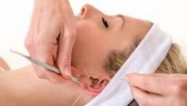 Durante el curso se revisan casos clínicos de distintas universidades chinas, cubanas y americanas, sobre diferentes temas relativos a la auriculoterapia