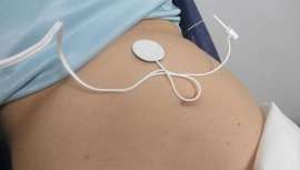 La talla perfecta y sin esfuerzo ya es posible gracias a los avances e investigación científica. Basado en la neuroestimulación del dermatona T6 del abdomen, nace Método T6, que hoy nos presenta la Dra. Ana Mª Téllez