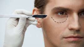 Son las intervenciones que más requieren los hombres y con las que ellos también consiguen verse mejor y permanecer por más tiempo jóvenes. El Dr. Antonio Tapia las enumera y aporta datos relevantes respecto del aumento de cirugías masculinas