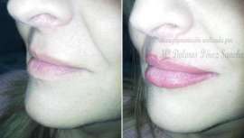 Revisamos con los expertos de Pretty Clinic, centro de estudios oficial, cómo, en qué casos y con qué resultados aplicar micropigmentación en los centros de belleza 