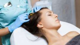 Este tratamento mesoterapeutico estimula o couro cabeludo e contribui para o crescimento do cabelo. Trata-se de uma boa alternativa a técnicas de transplante capilar, que precisam de cirurgia como a FUE (Extração Individual de Folículos)