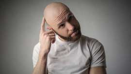 La generación en boca de todos sufre alopecia antes de hora. Así se desprende de varios estudios que ponen en duda el estilo de vida y los hábitos de los millennials 