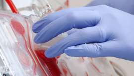 Spectra Optia, también conocido como PLEX o PEX, está recomendado para los procedimientos de aféresis. Indicado para tratar el síndrome de Guillain-Barre y la miasrenia gravis, utilizando intercambio de plasma terapéutico