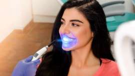 El blanqueamiento dental completa una buena imagen, es una manera de estar perfecta.