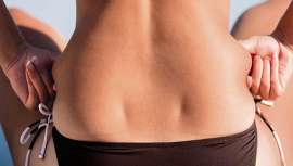 Accent Prime combina con precisión y puntería milimétrica ultrasonidos focalizados y radiofrecuencia. Se trata de un tratamiento personalizado que pretende dar en el blanco, cubriendo las necesidades de la clienta en el centro de estética