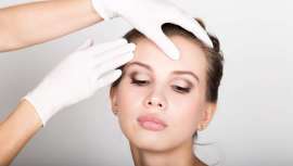 Se trata del procedimiento quirúrgico que se centra sólo en el tercio medio superior del rostro con una técnica precisa que le diferencia del resto. Revisamos los fundamentos del mismo y describimos pre y postoperatorio, así como resultados 