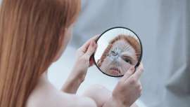 Este trastorno está relacionado con la preocupación fuera de lo normal por algún defecto, ya sea real o imaginado, de las características físicas de la persona