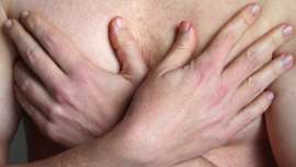 La ginecomastia, la alteración de las mamas masculinas, se opera frecuentemente en los centros médico-estéticos, tanto por exceso como por defecto