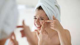 Consigue resultados visibles en dos semanas en el tratamiento de las pieles con tendencia acnéica. El tratamiento cuenta con varios productos que reducen y previenen eficazmente las manchas y calman las irritaciones