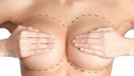 Nuevos datos ofrecidos por la Sociedad Americana de Cirugía Plástica Estética muestran que muchos procedimientos quirúrgicos cosméticos tradicionales siguen en aumento, y que representan el 77% de todos los negocios de médicos encuestados 