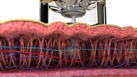 Muchas de las clínicas de cirugía, medicina estética y dermatología más potentes del mundo ya cuentan con ella desde hace un par de años. Ahora acaba de llegar a llegar a España y cuenta con diversos beneficios