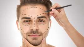 Muchas son las personas a las que preocupa el tamaño, considerado grande, de su frente. En la actualidad, y de las menos conocidas, existe una técnica quirúrgica, la frontoplastia, que también sirve para el levantamiento de cejas efecto lifting