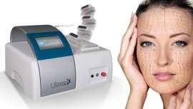 Este tratamiento de lifting no invasivo eleva cejas, pómulos y óvalo facial en una sola sesión