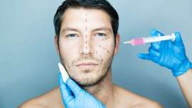 Así lo afirma uno de los cirujanos plásticos de mayor prestigio en nuestro país, el Dr. Arquero. En concreto, el 80% de los hombres que demandan una mejora estética lo hacen pasando por quirófano o a través de tratamientos de medicina estética