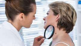 Los pacientes no suelen acudir al dermatólogo de forma rutinaria para hacerse un chequeo de lunares, sino que acude cuando la mancha o el lunar, que acaba siendo un cáncer de piel avanzado, es muy grande o les produce muchas molestias