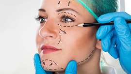 Las técnicas de cirugía estética más llevaderas en verano son las  cirugías que permiten embellecer la mama, así como la blefaroplastia o corrección de las bolsas de los ojos y párpados caídos