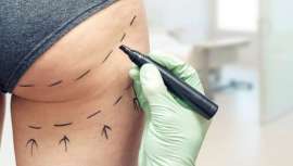 Distintas asociaciones de cirugía plástica y estética del mundo alertan sobre su elevado índice de mortalidad