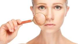 La doctora María José Barba, especialista en medicina estética, nos guía para conocer el tipo de manchas y seguir el tratamiento adecuado para combatirlas de la forma más eficaz