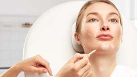 Un óvalo facial firme, con un aspecto terso y joven es posible gracias a inyectables con activos quemagrasa realmente efectivos